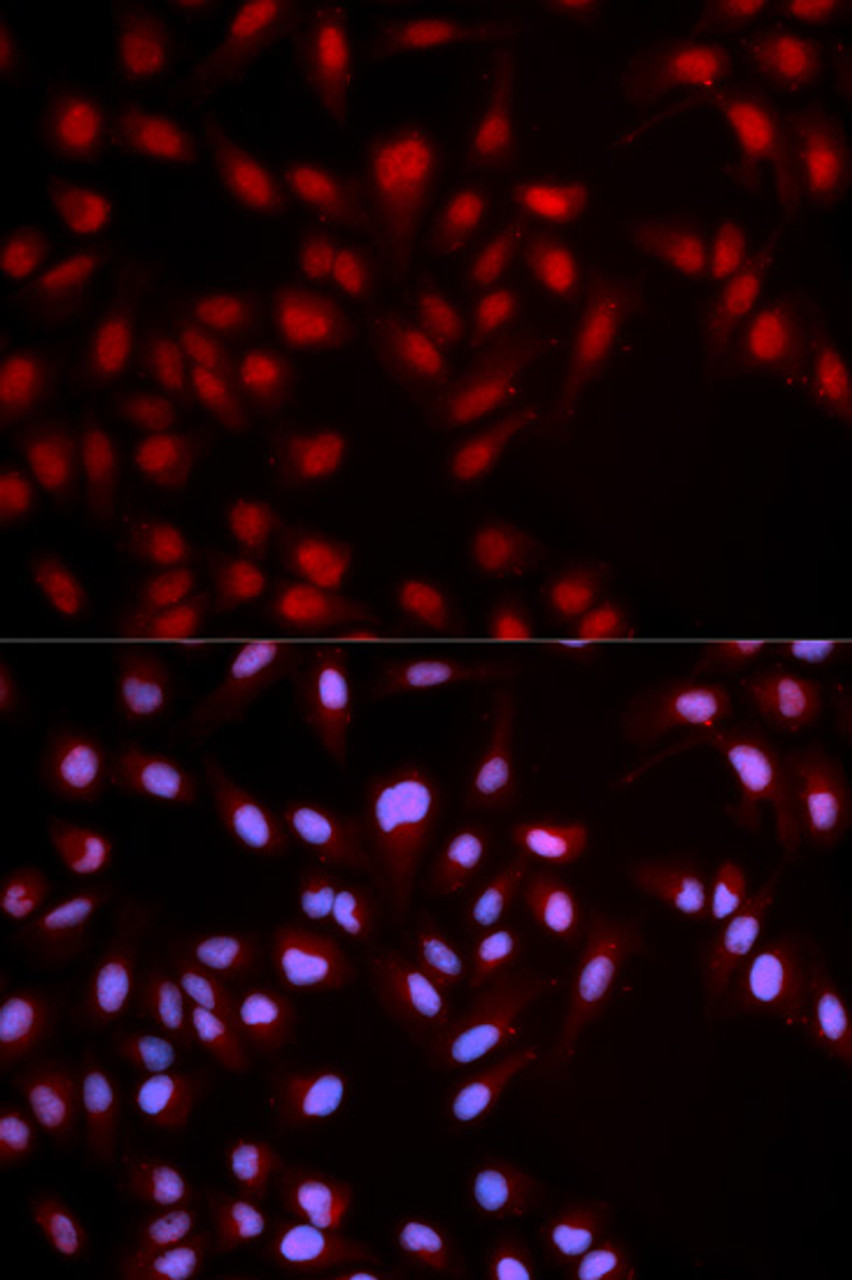 Immunofluorescence analysis of U2OS cells using Phospho-MET(Y1349) Polyclonal Antibody