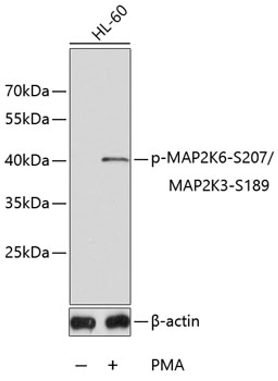 Western blot analysis of extracts of HL60 cell lines using Phospho-MAP2K6(S207)/MAP2K3(S189) Polyclonal Antibody.