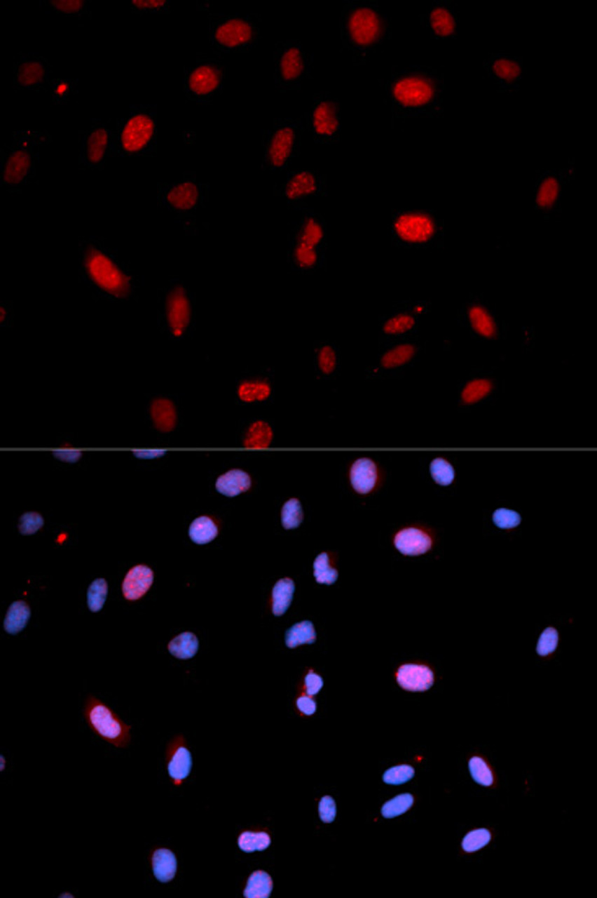 Immunofluorescence analysis of U2OS cells using Phospho-MAP2K6(S207)/MAP2K3(S189) Polyclonal Antibody