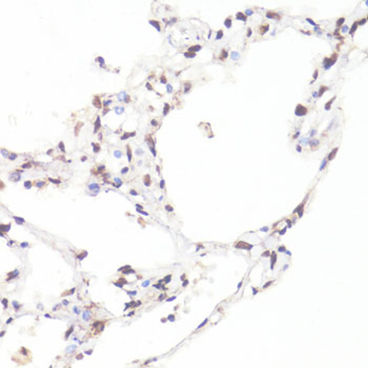 Immunohistochemistry of paraffin-embedded Human lung using Phospho-MYC(S62) Polyclonal Antibody at dilution of  1:100 (40x lens).