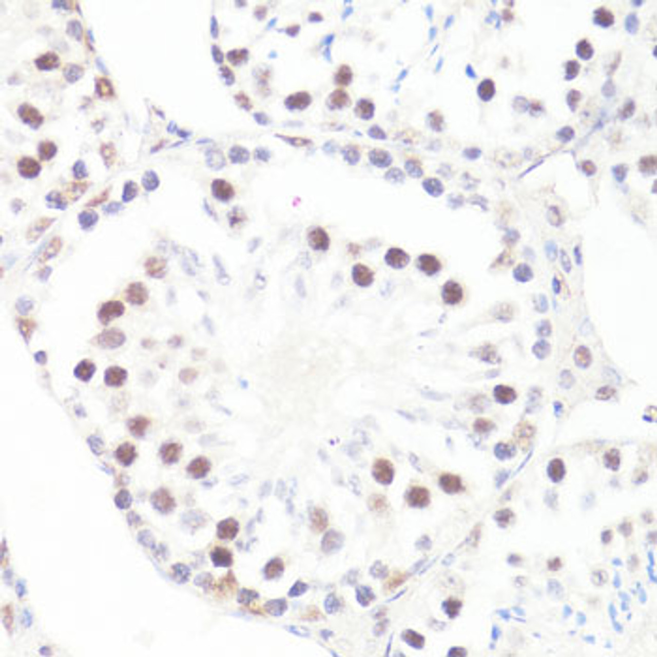 Immunohistochemistry of paraffin-embedded Mouse testis using Phospho-MYC(S62) Polyclonal Antibody at dilution of  1:100 (40x lens).