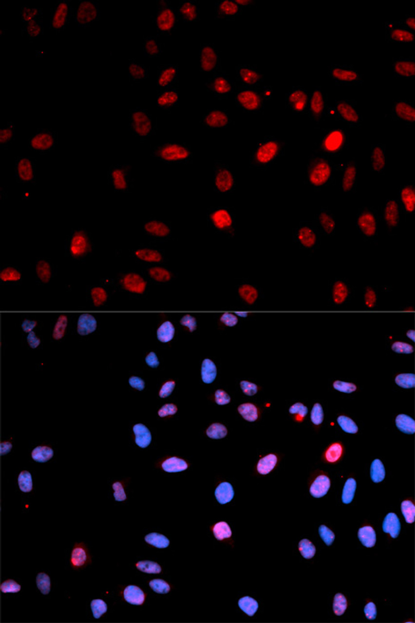 Immunofluorescence analysis of U2OS cells using Phospho-p53(S15) Polyclonal Antibody