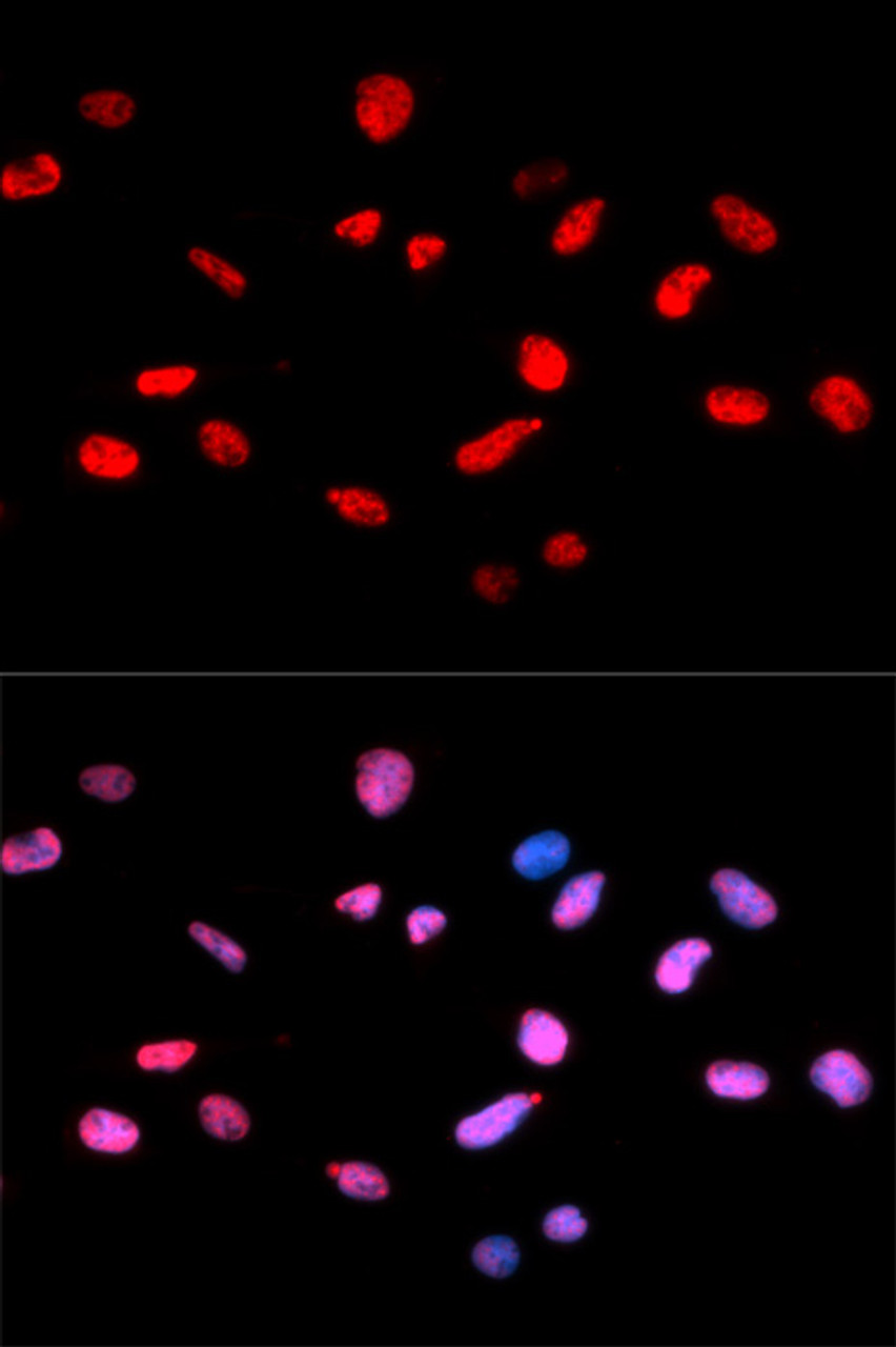 Immunofluorescence analysis of U2OS cells using Phospho-Rb(S811) Polyclonal Antibody