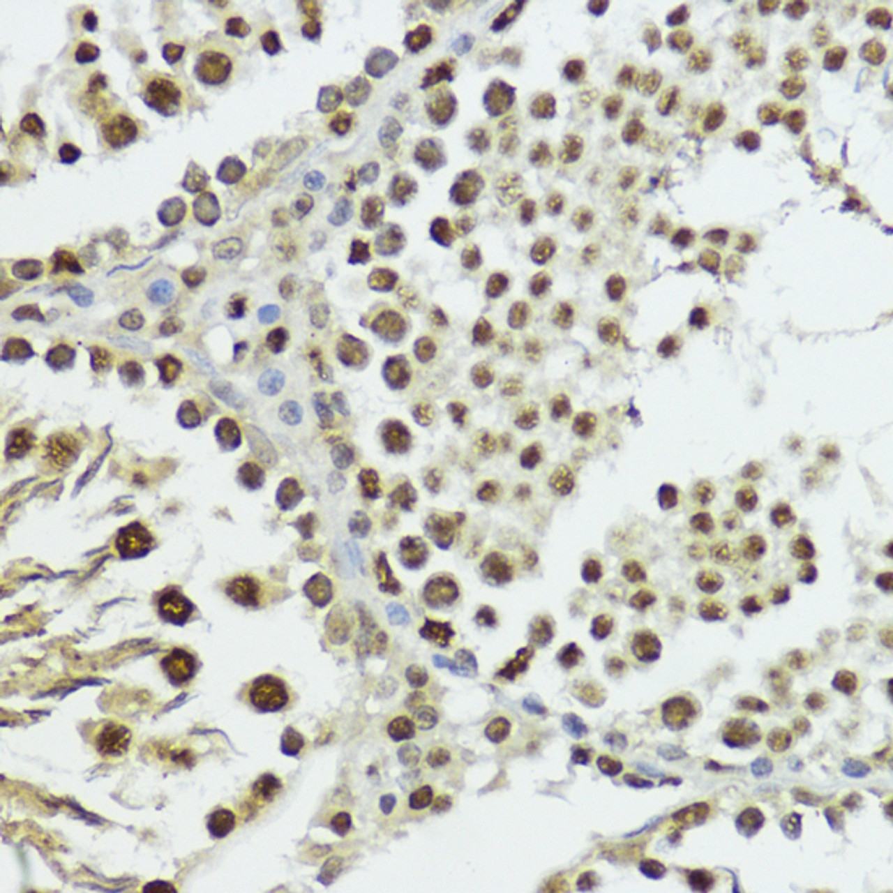 Immunohistochemistry of paraffin-embedded Rat testis using Phospho-Histone H3(T11) Polyclonal Antibody at dilution of  1:100 (40x lens).