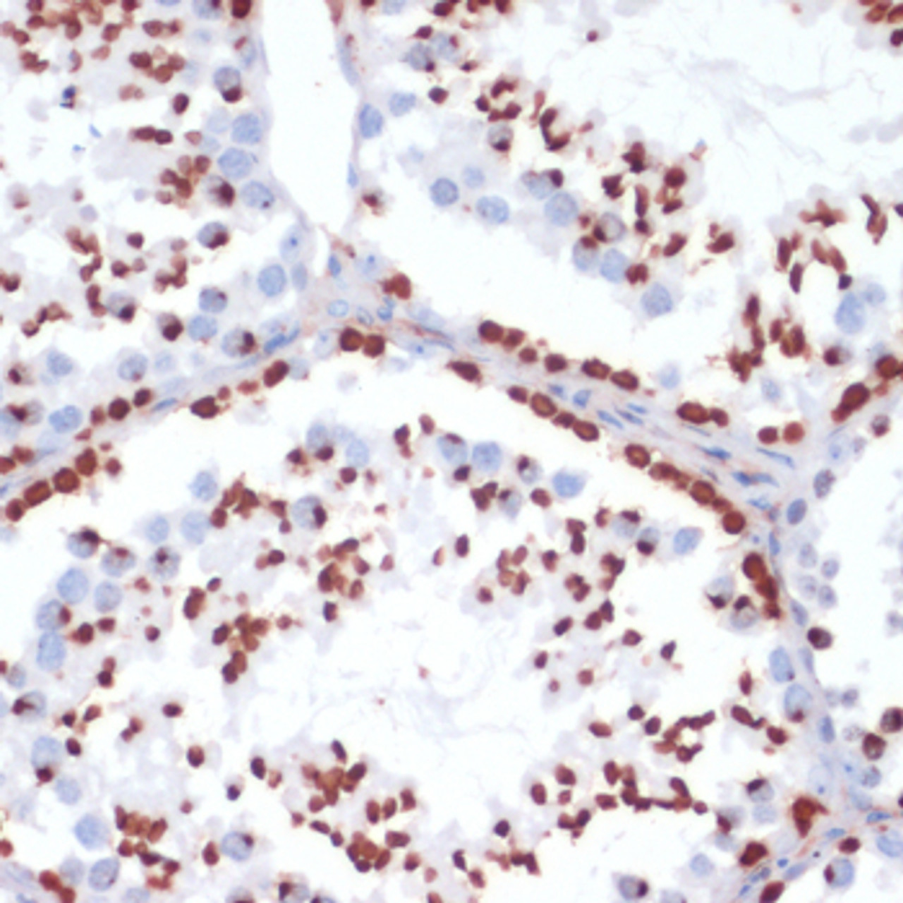 Immunohistochemistry of paraffin-embedded Mouse testis using Phospho-γH2A.X(S139) Polyclonal Antibody at dilution of  1:200 (40x lens).