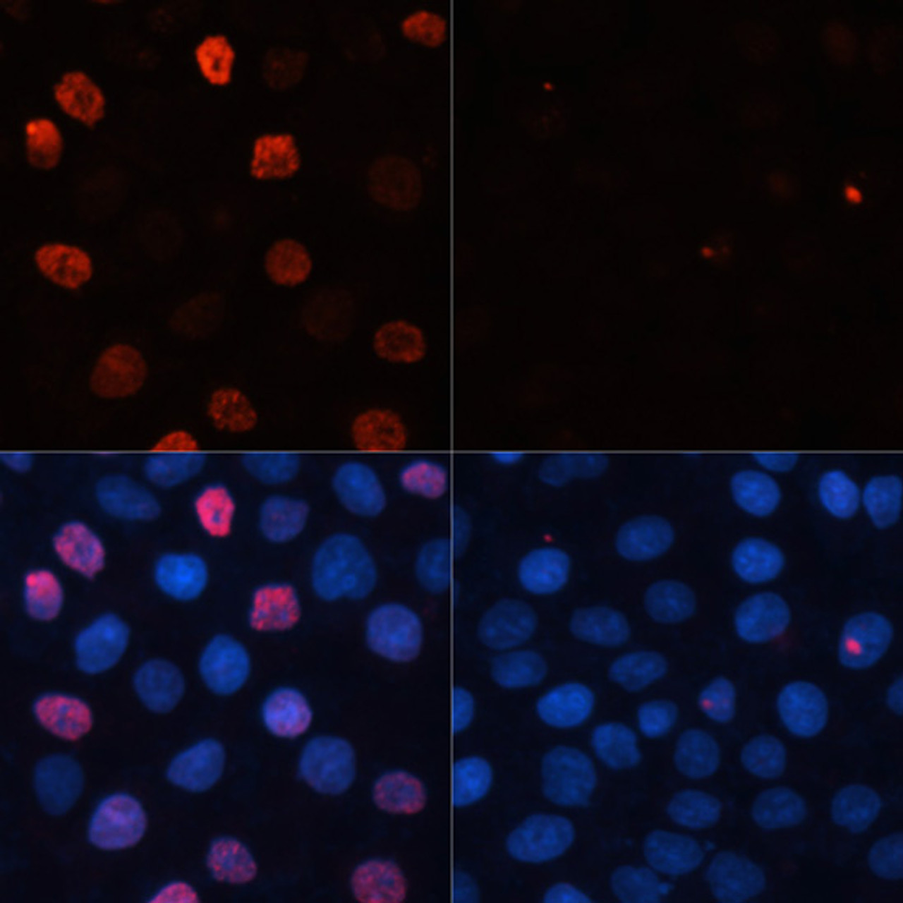 Immunofluorescence analysis of HeLa cells using Phospho-γH2A.X(S139) Polyclonal Antibody at dilution of  1:100. Blue: DAPI for nuclear staining.HeLa cells were treated by UV for 15-30 minutes at RT (left). Blue: DAPI for nuclear staining.