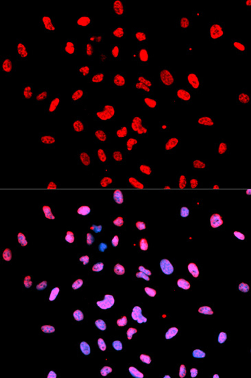 Immunofluorescence analysis of U2OS cells using Phospho-Btk(Y223) Polyclonal Antibody