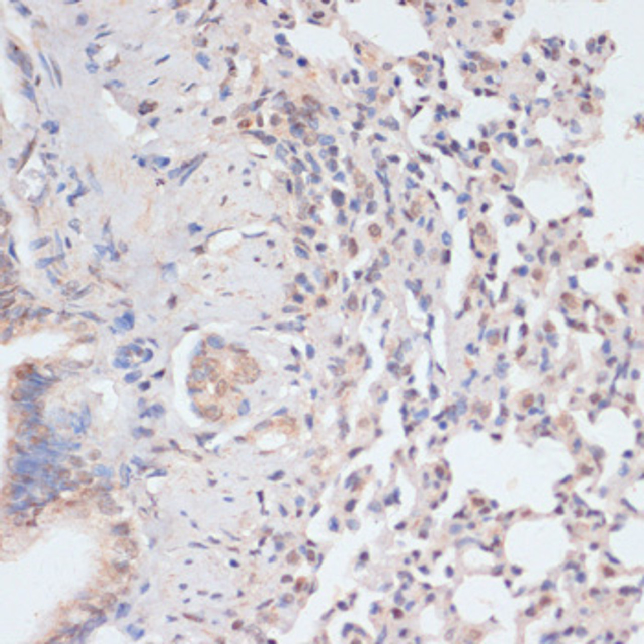 Immunohistochemistry of paraffin-embedded Rat lung using Phospho-STAT1(S727) Polyclonal Antibody at dilution of  1:100 (40x lens).