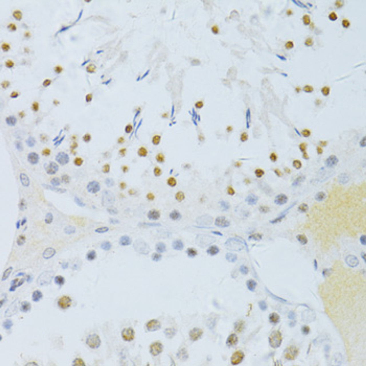 Immunohistochemistry of paraffin-embedded Rat testis using Phospho-NF-kB p65(S276) Polyclonal Antibody at dilution of  1:100 (40x lens).