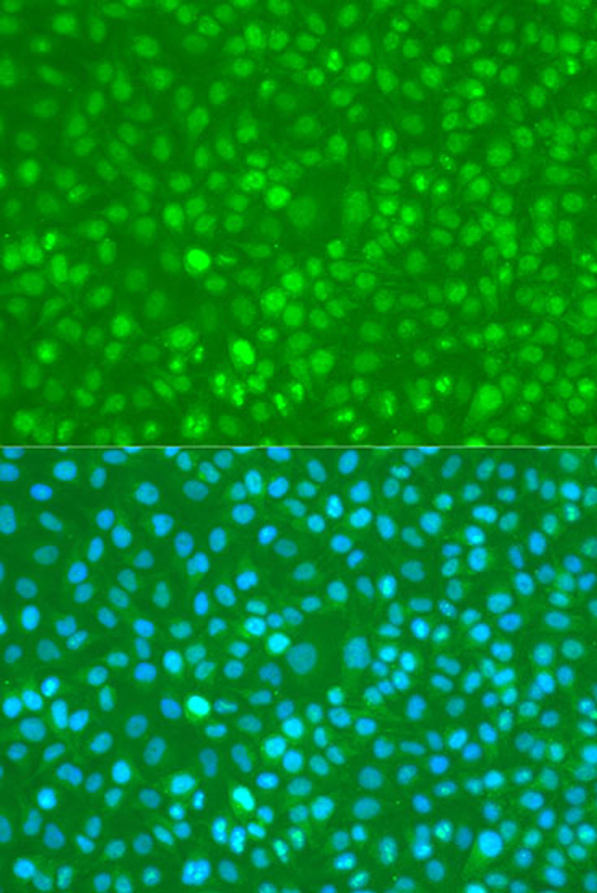 Immunofluorescence analysis of U2OS cells using Phospho-NF-kB p65(S276) Polyclonal Antibody at dilution of  1:100. Blue: DAPI for nuclear staining.