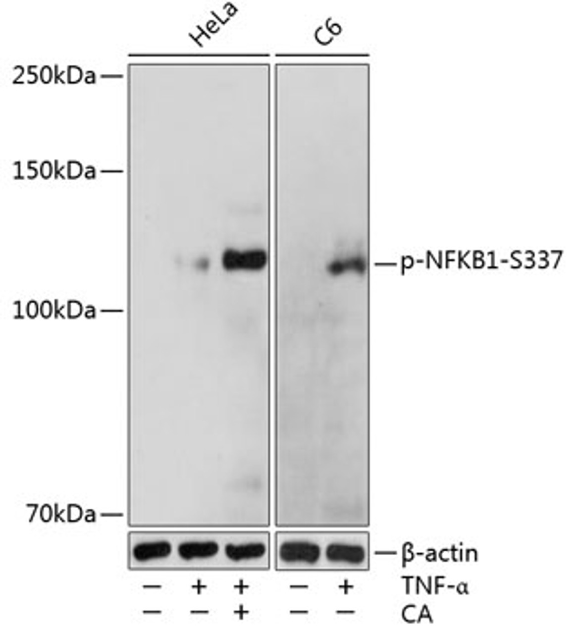 Western blot analysis of extracts of various cell lines using Phospho-NFKB1(S337) Polyclonal Antibody at dilution of 1:1000. HeLa cells were treated by TNF-α (20 ng/ml) and Calyculin A (100 nM) at 37°C for 10 minutes. C6 cells were treated by TNF-α (20 ng/ml) at 37°C for 10 minutes.