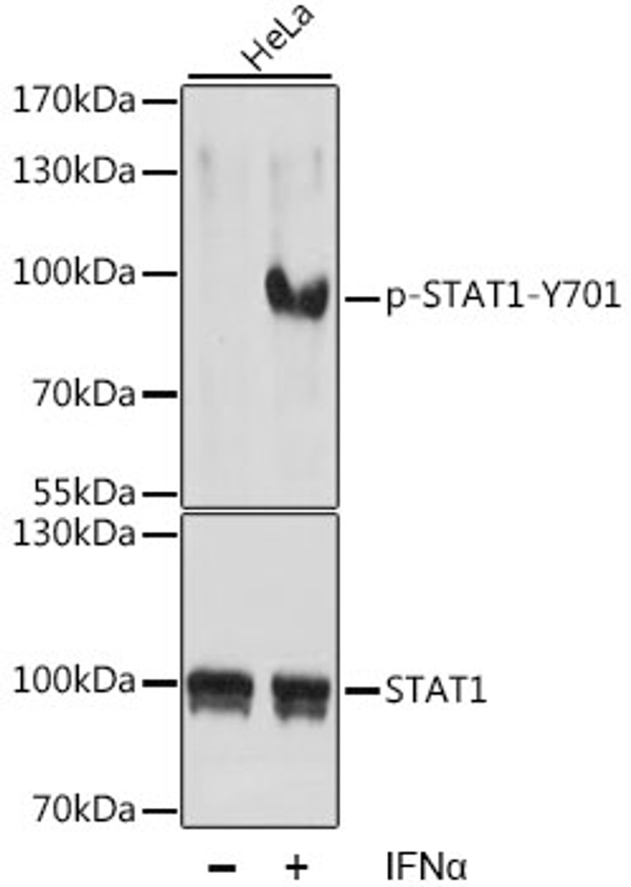 Western blot analysis of extracts of HeLa cells using Phospho-STAT1(Y701) Polyclonal Antibody at dilution of 1:1000.