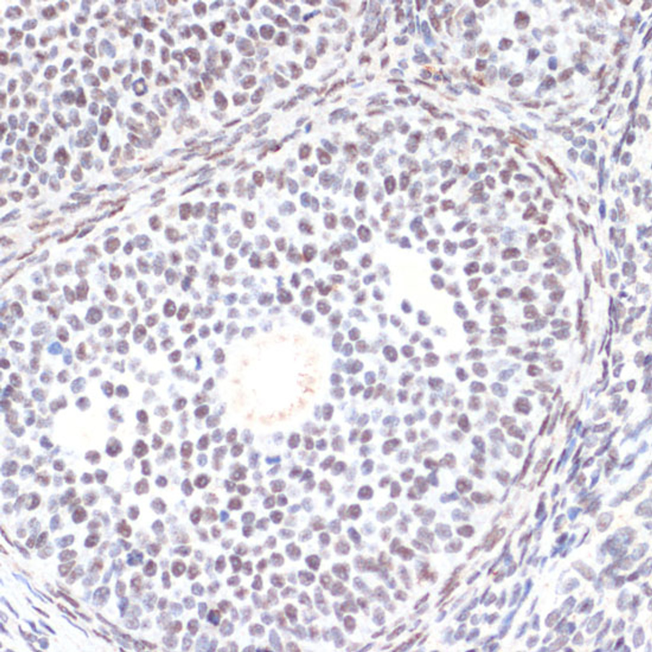 Immunohistochemistry of paraffin-embedded Rat ovary using Phospho-AKT(S473) Polyclonal Antibody at dilution of  1:200 (40x lens).