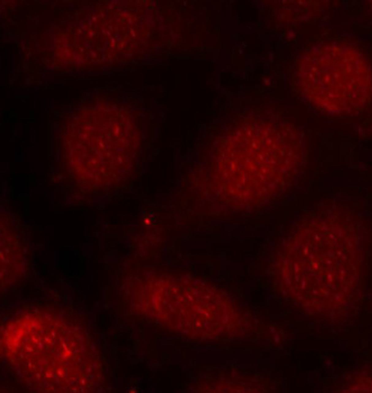 Immunofluorescence analysis of methanol-fixed MCF-7 cells using Phospho-PKCalpha/beta II(T638/641) Polyclonal Antibody
