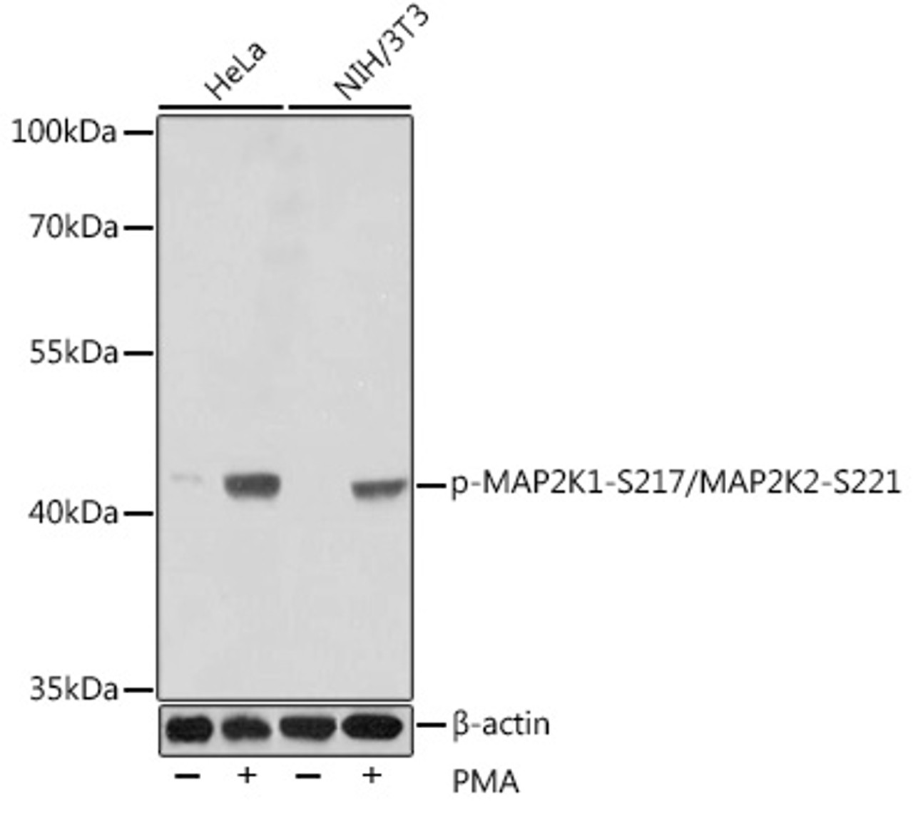 Western blot analysis of extracts of various cell lines using Phospho-MAP2K1（S217）/MAP2K2（S221） Polyclonal Antibody.