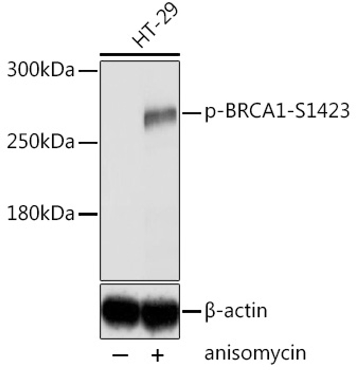 Western blot analysis of extracts of HT-29 cells using Phospho-BRCA1(S1423) Polyclonal Antibody at dilution of 1:2000. HT-29 cells were treated by Anisomycin (5ug/ml) for 30 minutes after serum-starvation overnight.