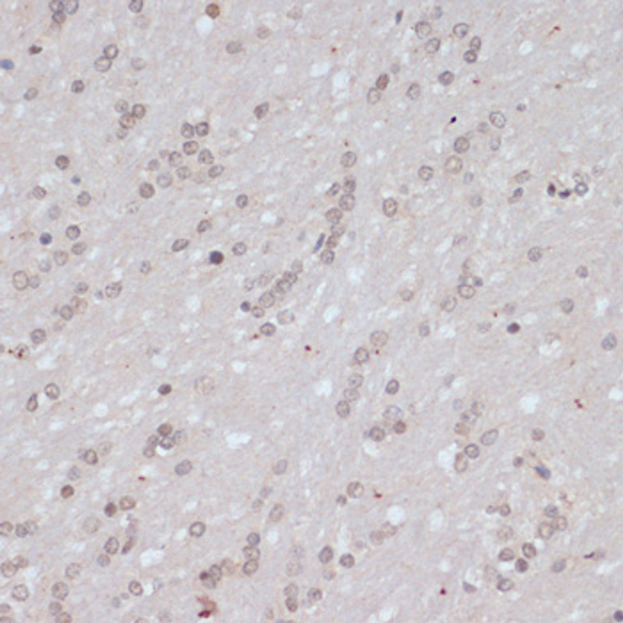 Immunohistochemistry of paraffin-embedded Rat brain using Phospho-BRCA1(S1423) Polyclonal Antibody at dilution of  1:100 (40x lens).