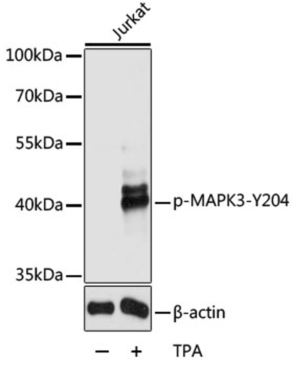 Western blot analysis of extracts of Jurkat cells using Phospho-MAPK3(Y204) Polyclonal Antibody at dilution of 1:2000.