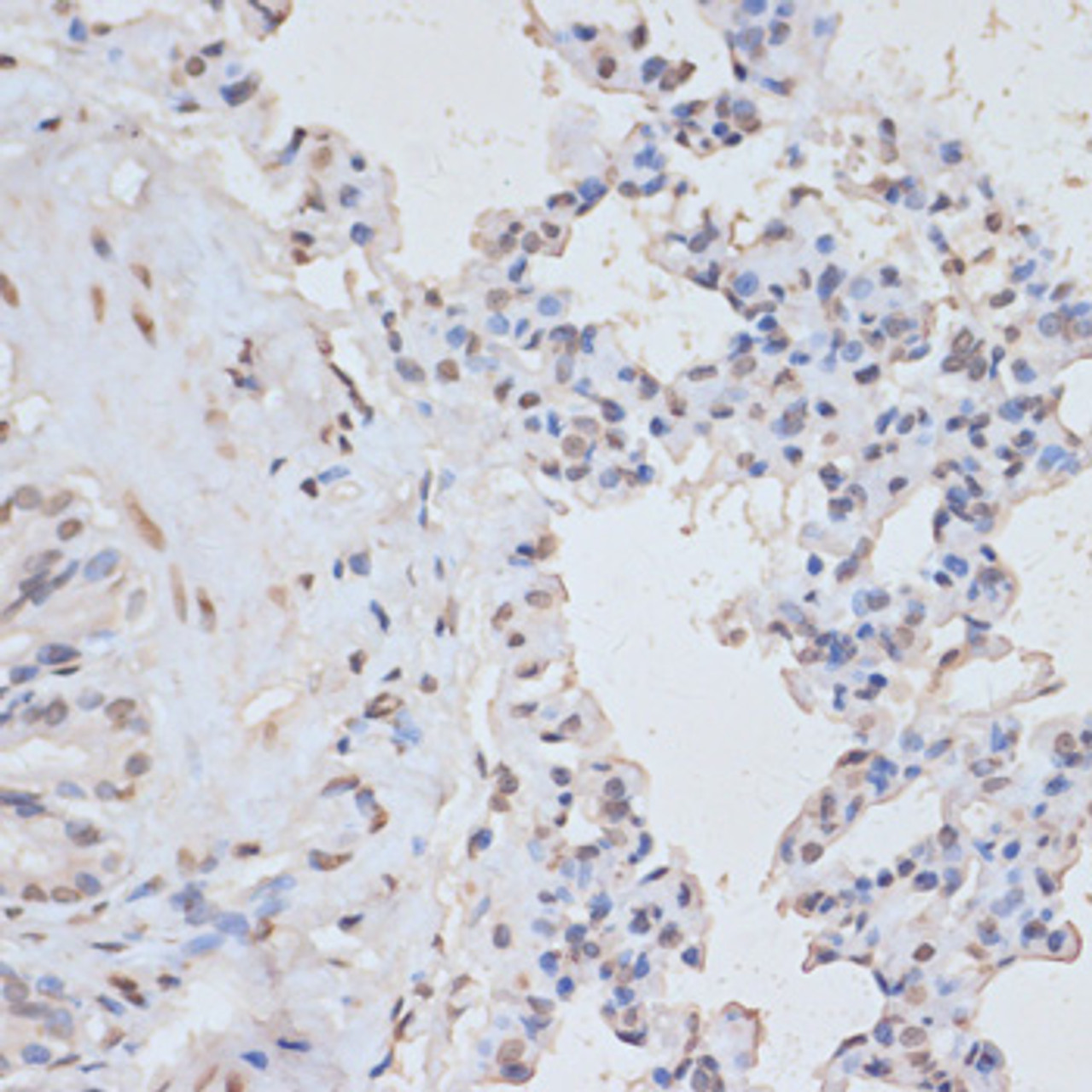 Immunohistochemistry of paraffin-embedded Rat lung using Phospho-MAPK3(Y204) Polyclonal Antibody at dilution of  1:100 (40x lens).