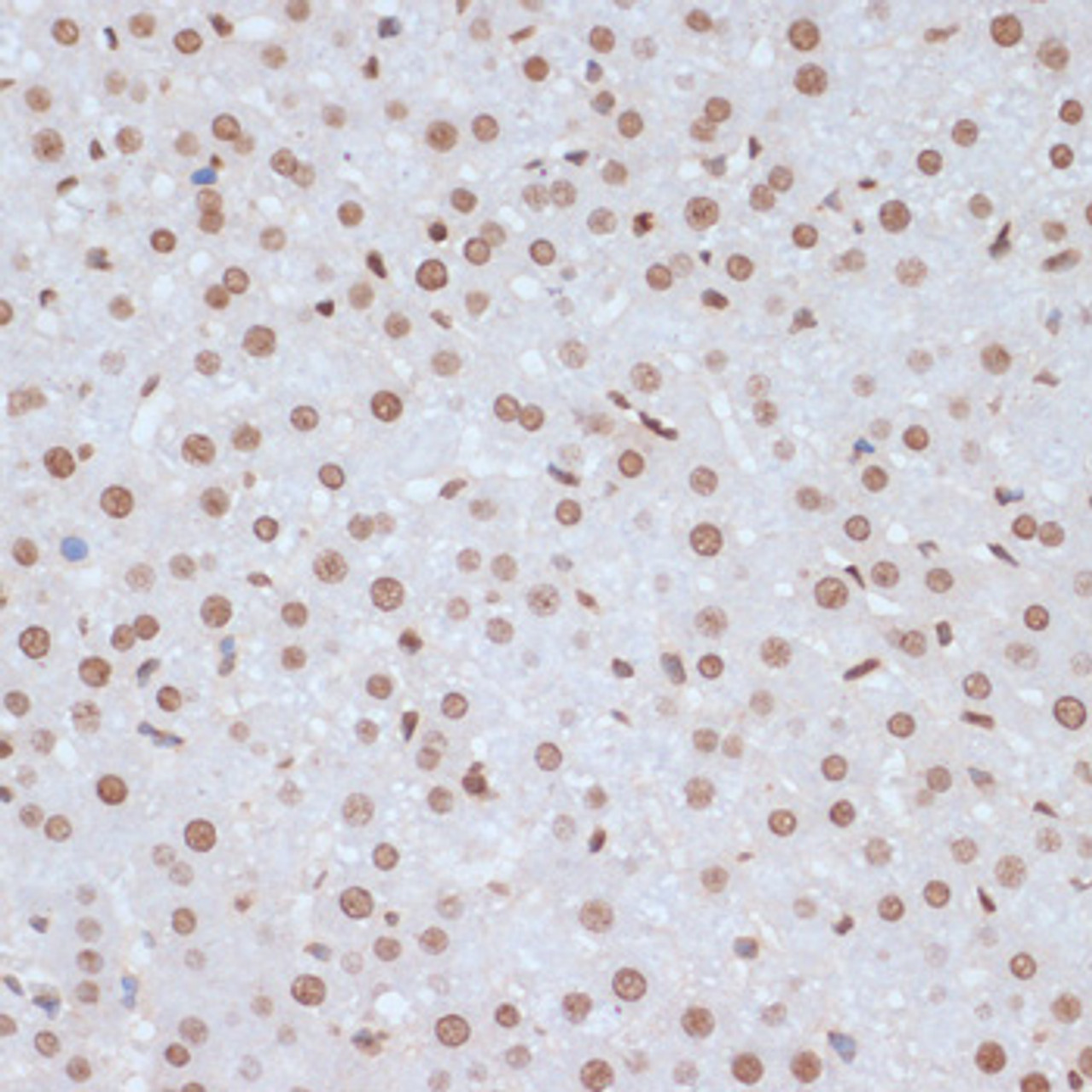 Immunohistochemistry of paraffin-embedded Rat liver using Phospho-MAPK3(Y204) Polyclonal Antibody at dilution of  1:100 (40x lens).