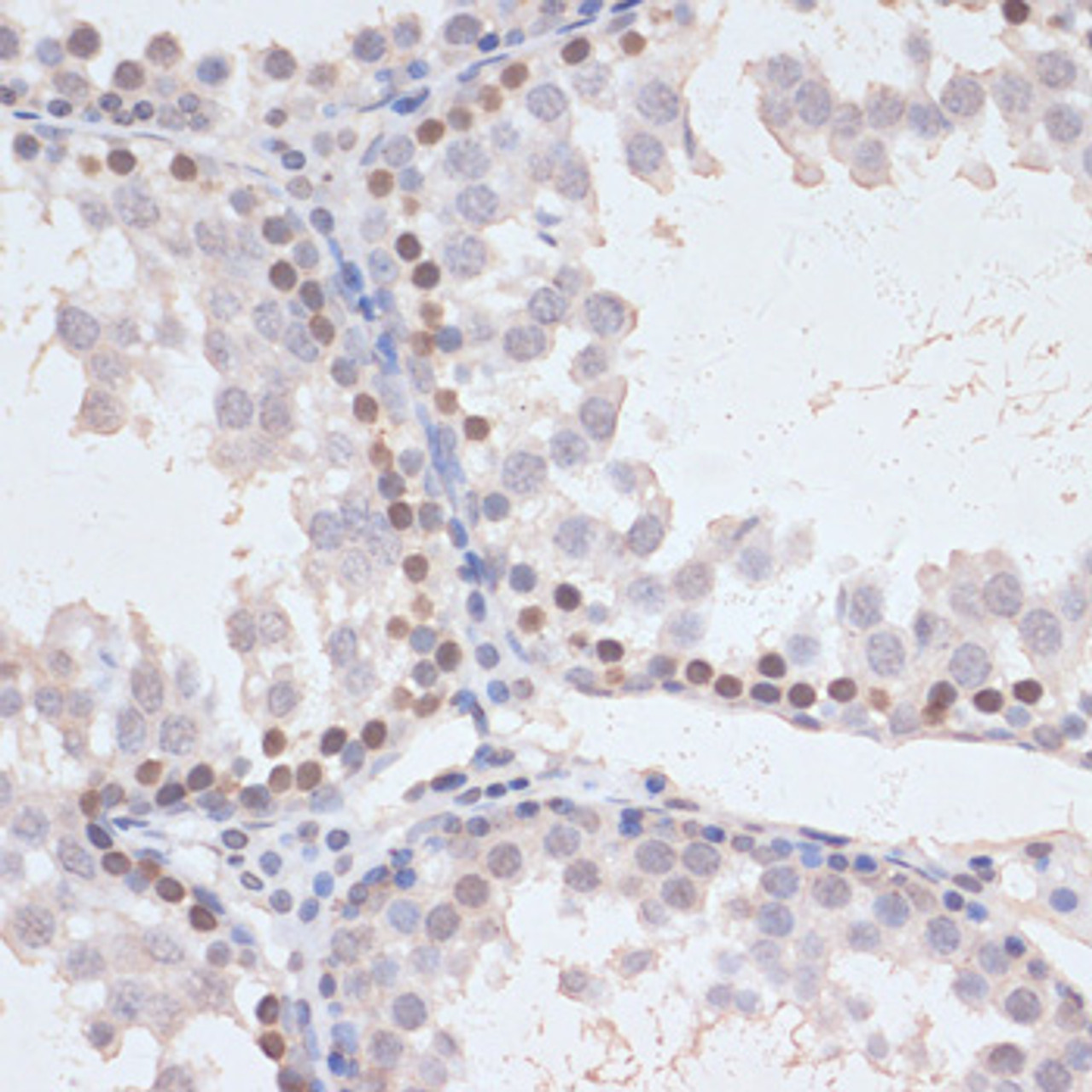 Immunohistochemistry of paraffin-embedded Rat testis using Phospho-MAPK3(Y204) Polyclonal Antibody at dilution of  1:100 (40x lens).