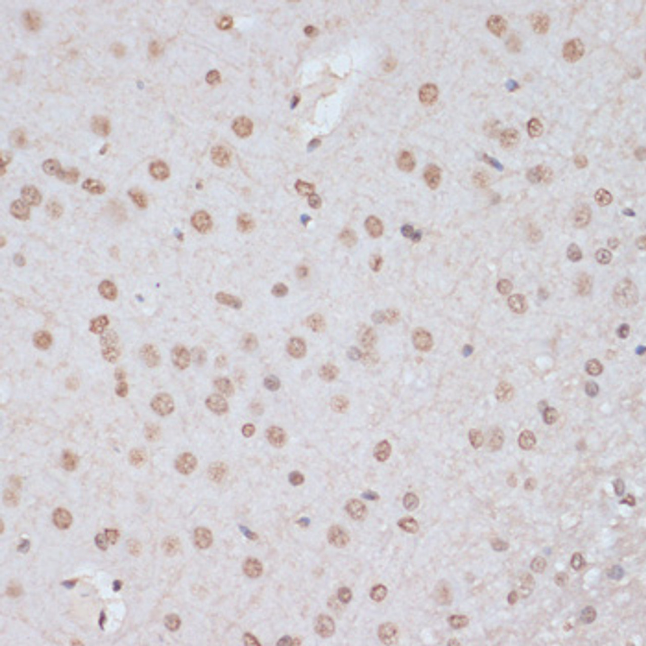 Immunohistochemistry of paraffin-embedded Rat brain using Phospho-MAPK3(Y204) Polyclonal Antibody at dilution of  1:100 (40x lens).