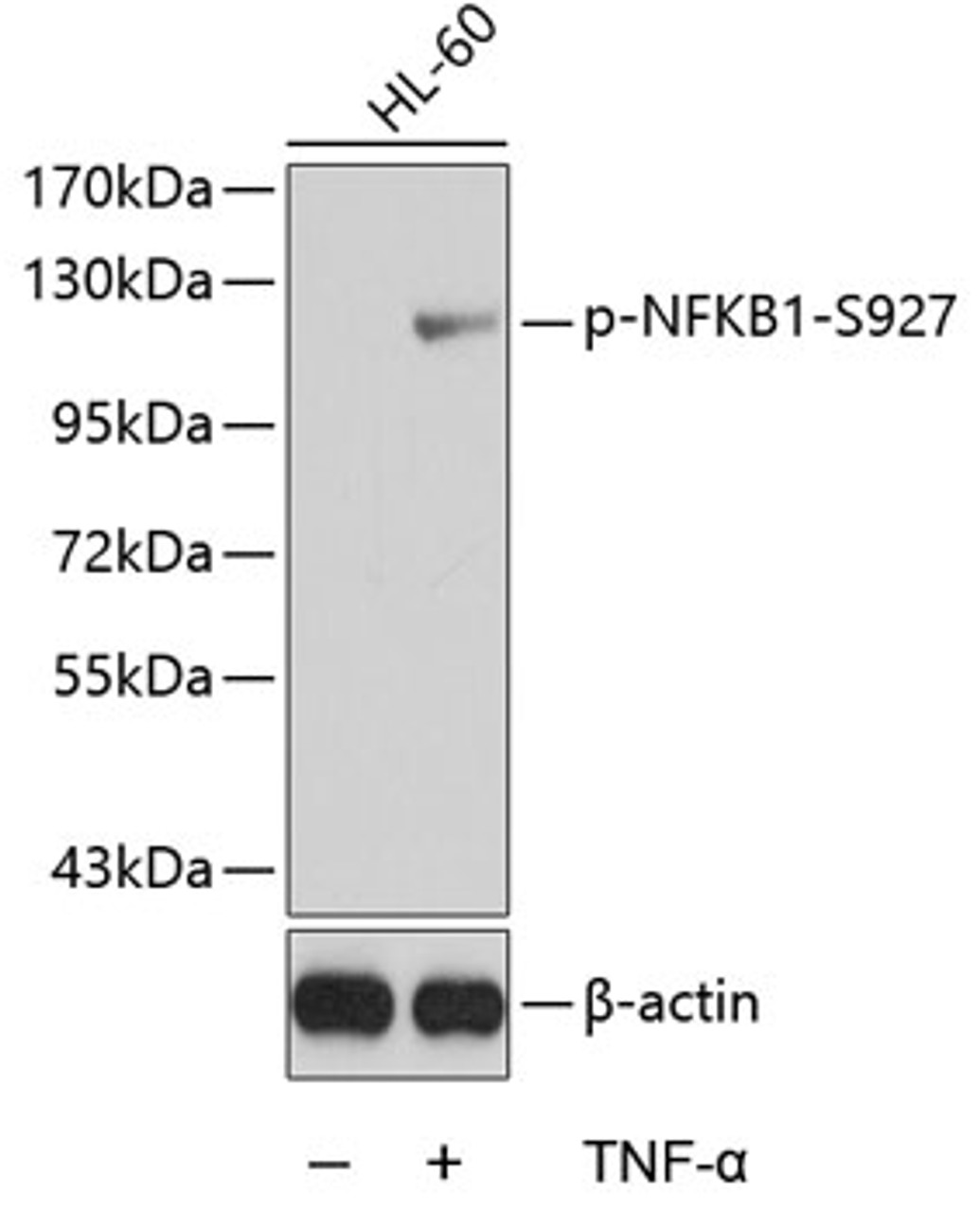 Western blot analysis of extracts from HL60 cells using Phospho-NFKB1(S927) Polyclonal Antibody.