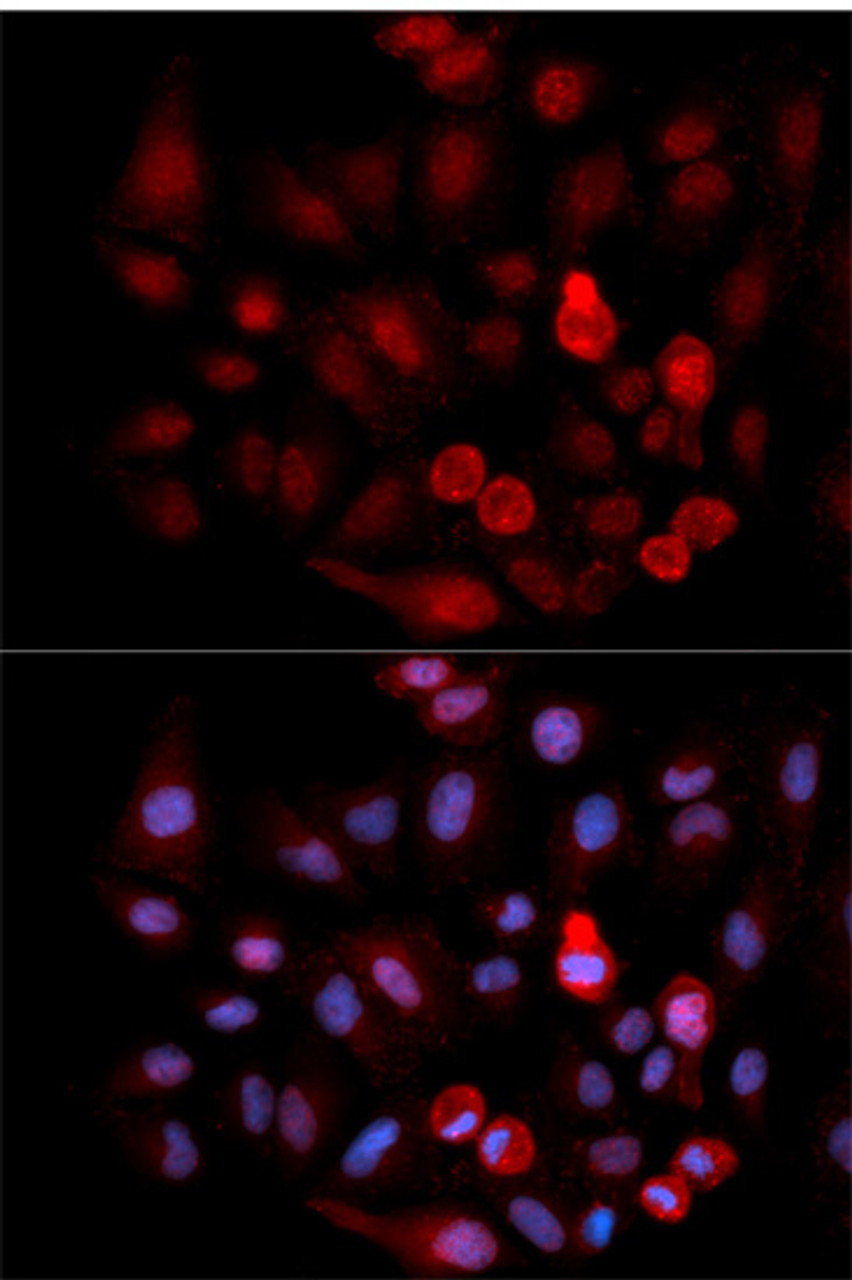 Immunofluorescence analysis of MCF-7 cells using Phospho-ABL1(Y412) Polyclonal Antibody