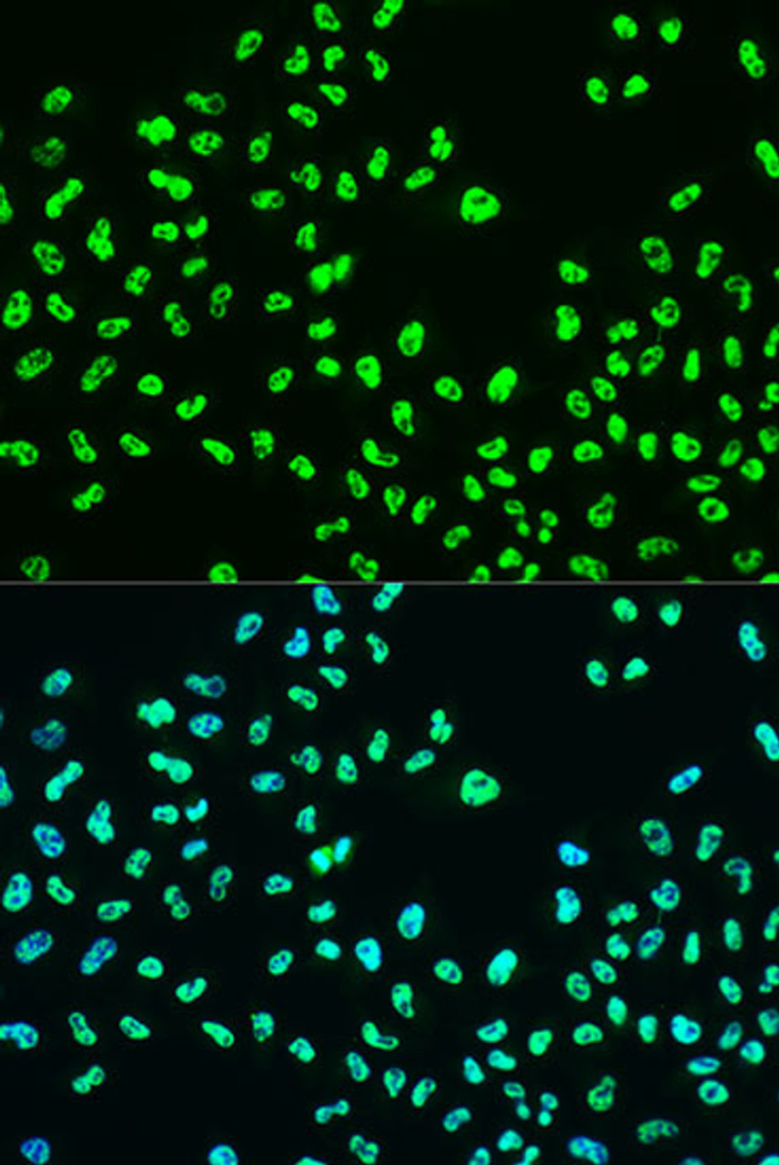 Immunofluorescence analysis of U2OS cells using Phospho-BRCA1(S988) Polyclonal Antibody at dilution of  1:100. Blue: DAPI for nuclear staining.