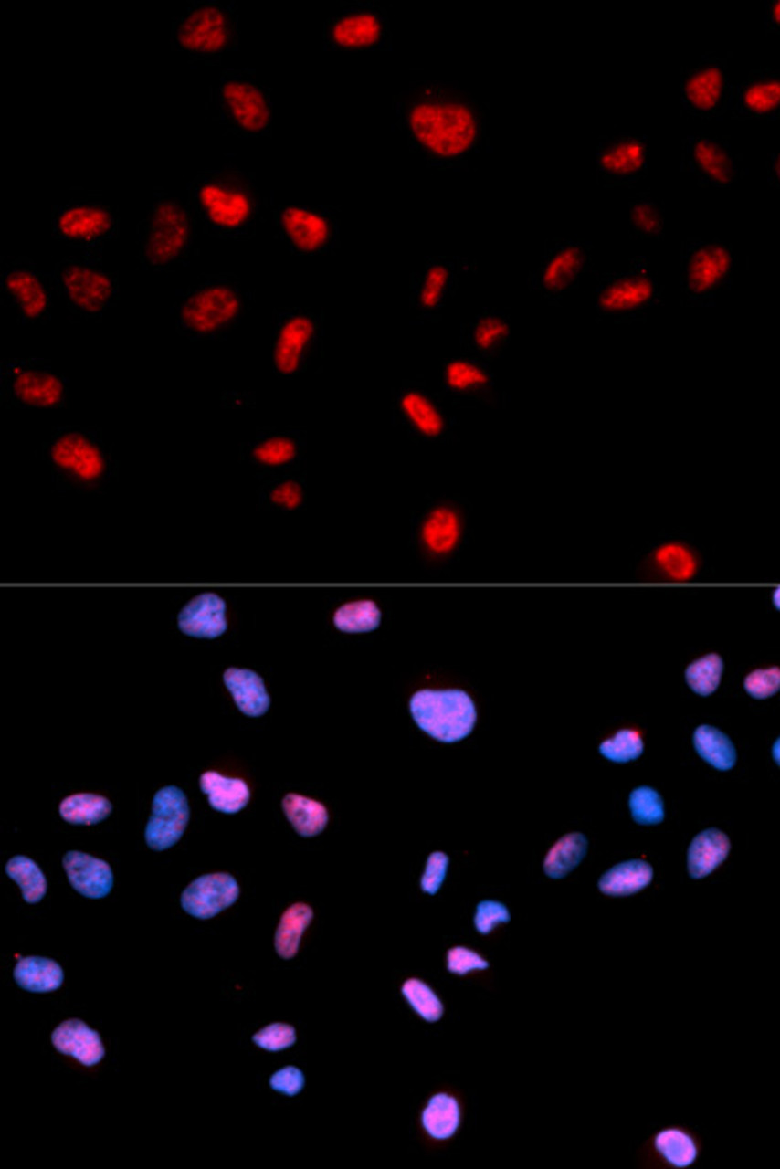 Immunofluorescence analysis of MCF-7 cells using Phospho-CDK1(T161) Polyclonal Antibody