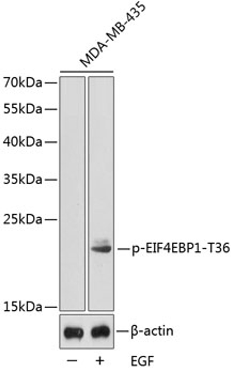 Western blot analysis of extracts from MDA-MB-435 cells using Phospho-EIF4EBP1(T36) Polyclonal Antibody.