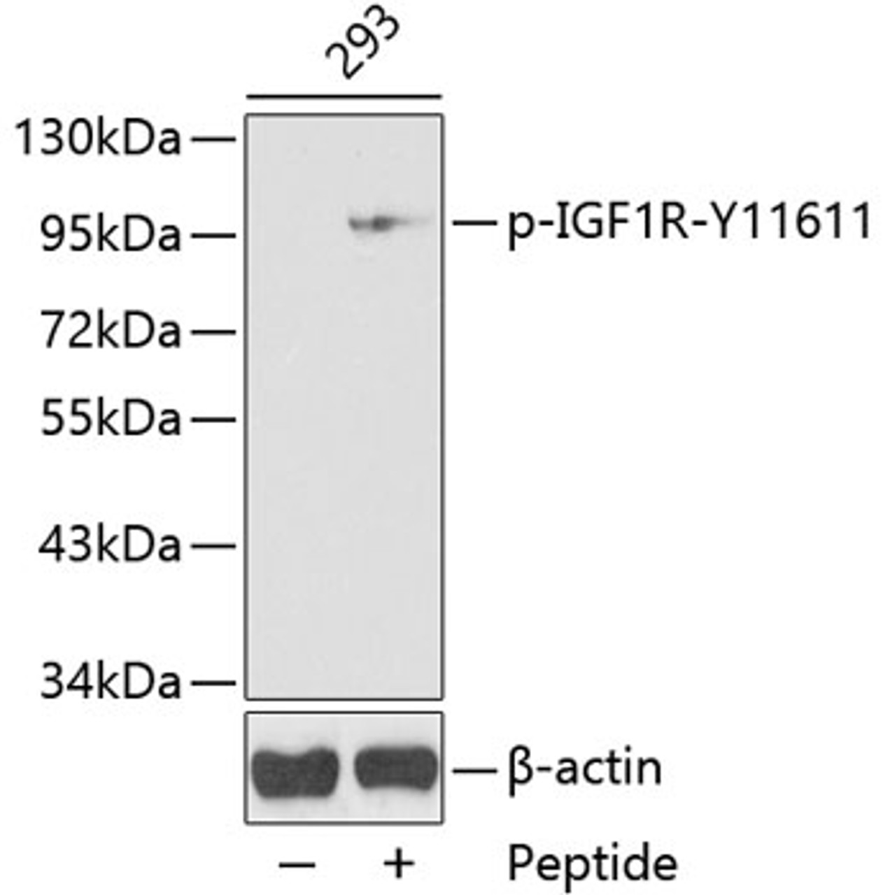 Western blot analysis of extracts from 293 cells using Phospho-IGF1R(Y1161) Polyclonal Antibody.