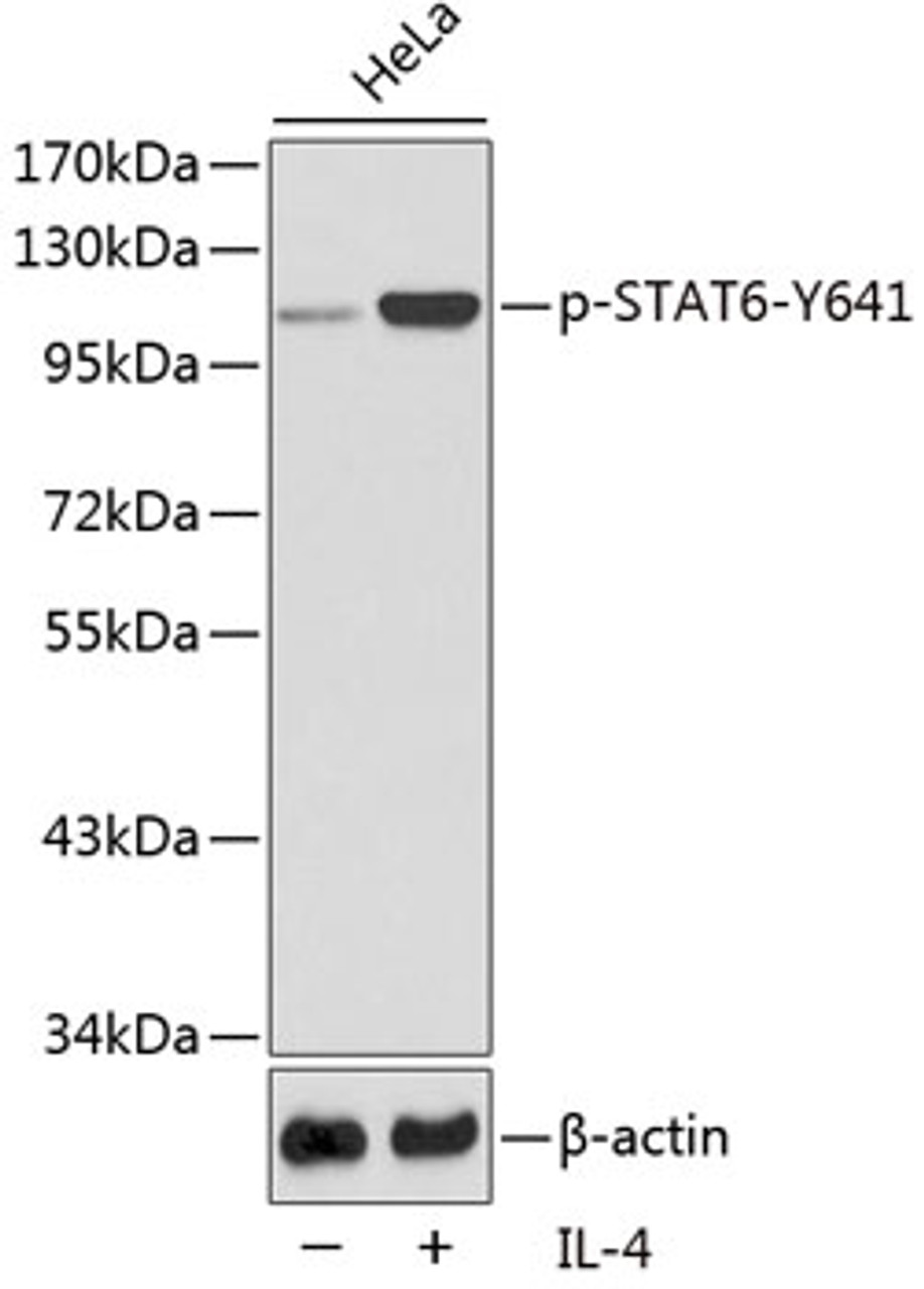 Western blot analysis of extracts from HeLa cells using Phospho-STAT6(Y641) Polyclonal Antibody.