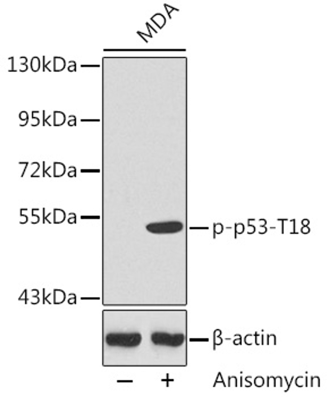 Western blot analysis of extracts from MDA cells using Phospho-p53(T18) Polyclonal Antibody.