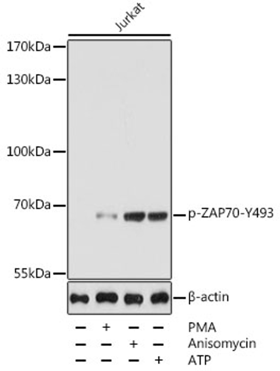 Western blot analysis of extracts of Jurkat cells using Phospho-ZAP70(Y493) Polyclonal Antibody at dilution of 1:5000.
