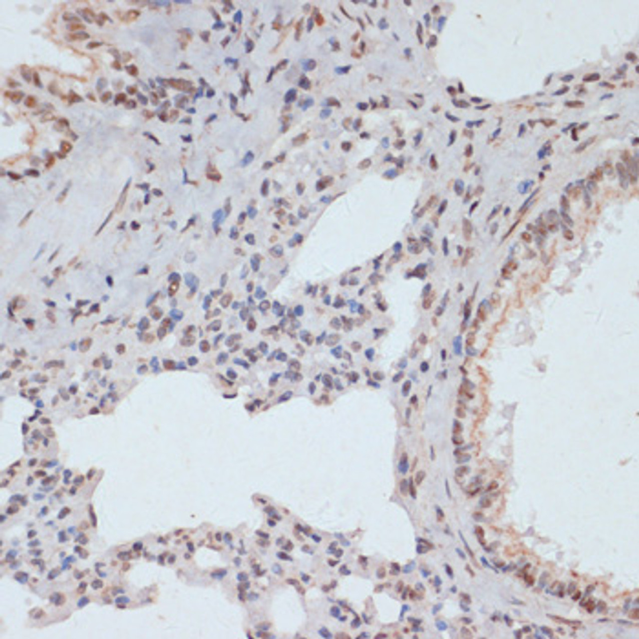 Immunohistochemistry of paraffin-embedded Rat lung using Phospho-ERK1（T202/Y204）/ ERK2（T185/Y187） Polyclonal Antibody at dilution of  1:100 (40x lens).