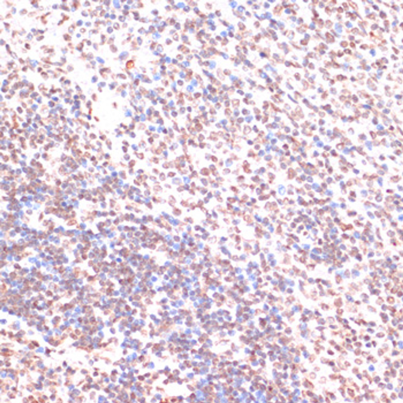 Immunohistochemistry of paraffin-embedded Rat spleen using Phospho-ERK1（T202/Y204）/ ERK2（T185/Y187） Polyclonal Antibody at dilution of  1:100 (40x lens).