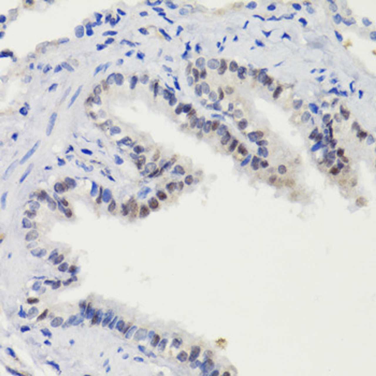 Immunohistochemistry of paraffin-embedded Rat lung using Phospho-Stat3(S727) Polyclonal Antibody at dilution of  1:100 (40x lens).