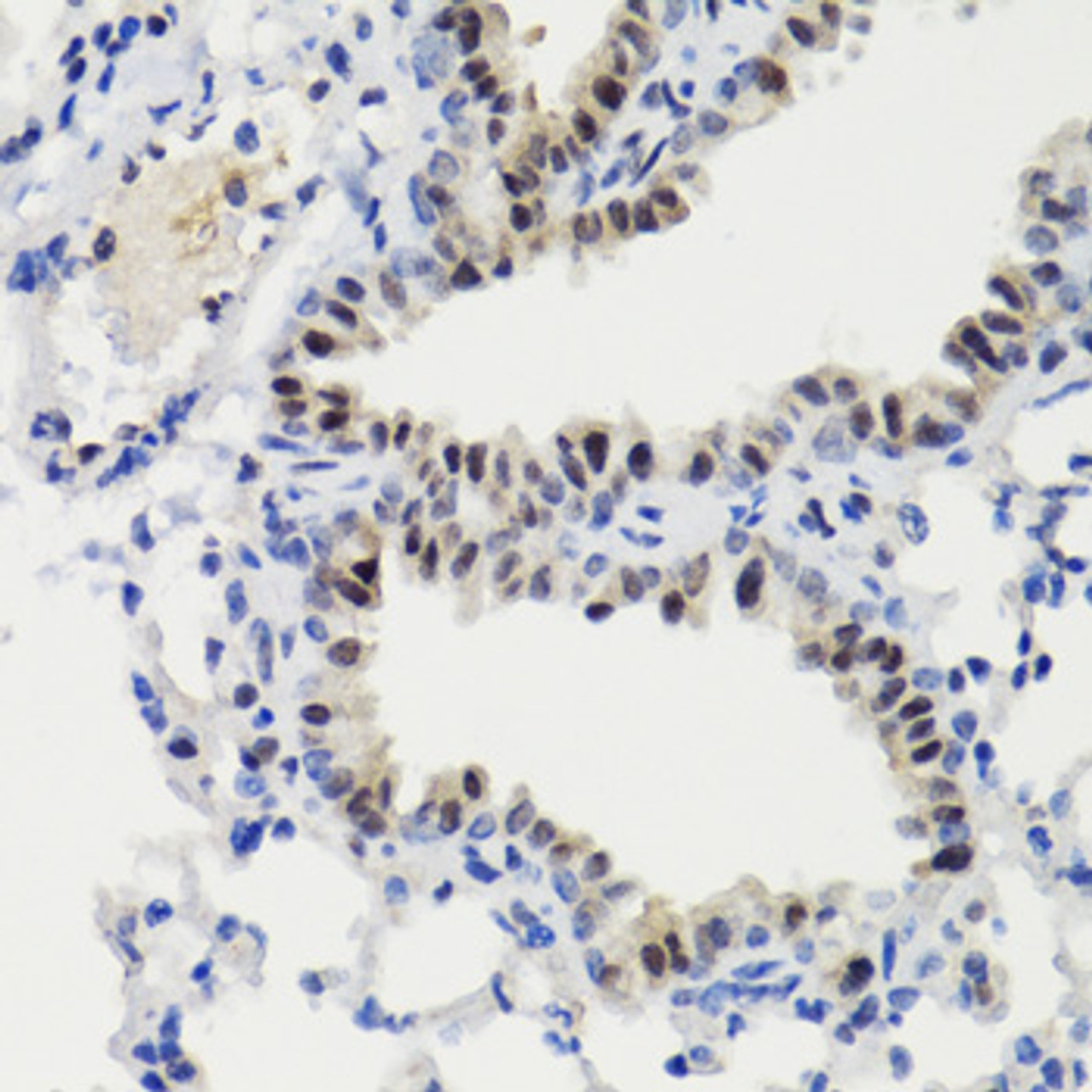 Immunohistochemistry of paraffin-embedded Mouse lung using Phospho-Stat3(S727) Polyclonal Antibody at dilution of  1:100 (40x lens).