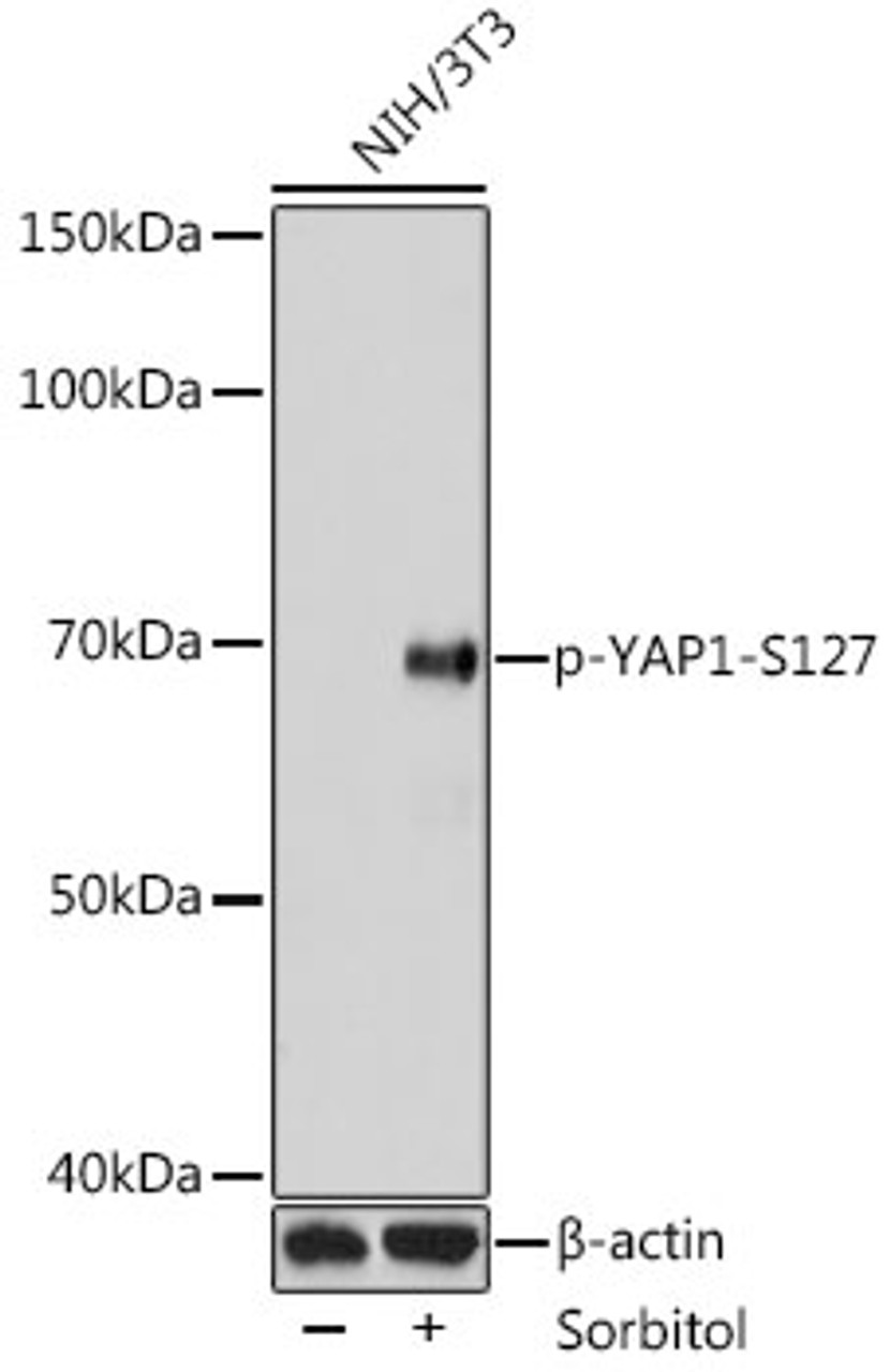 Western blot analysis of extracts of NIH3T3 cells using Phospho-YAP1(S127) Polyclonal Antibody at dilution of 1:1000. NIH3T3 cells were treated by Sorbitol (0. 2M) at 37°C for 60 minutes after serum-starvation overnight.