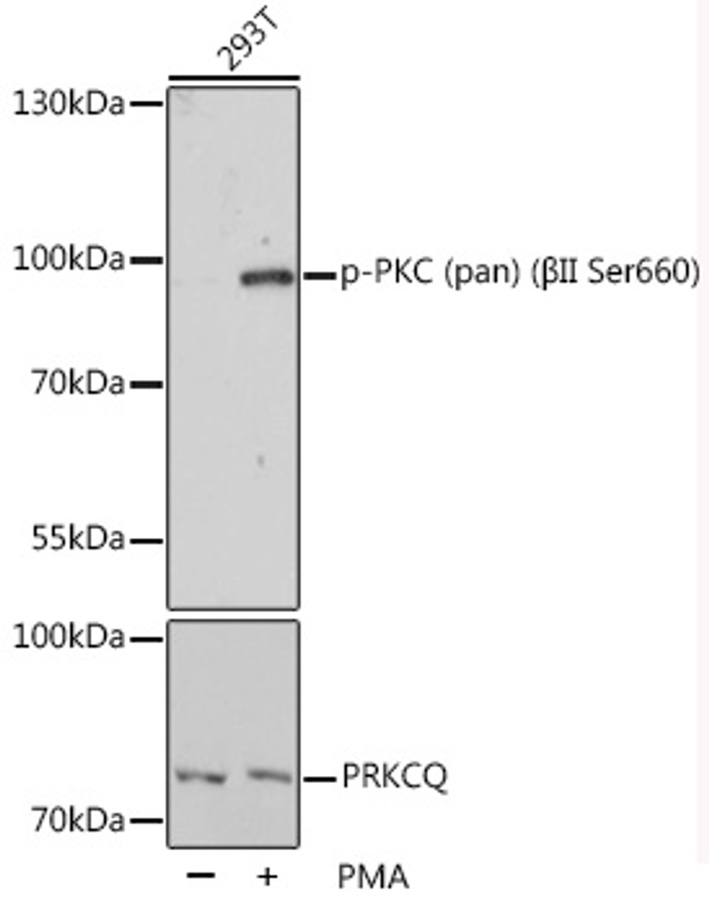 Western blot analysis of extracts of 293T cells using Phospho-PKC (pan) (βII Ser660) Polyclonal Antibody at dilution of 1:1000.