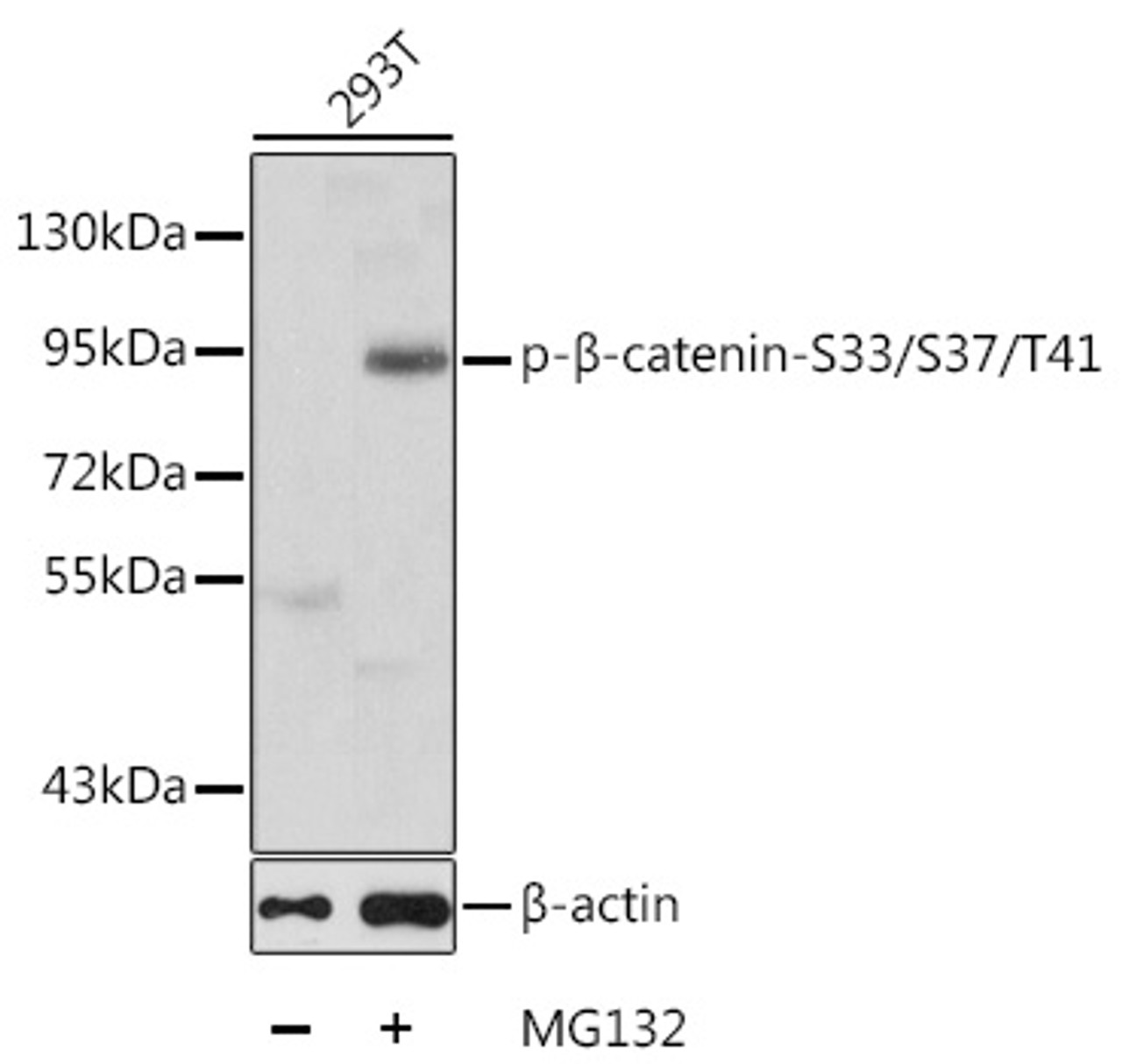 Western blot analysis of extracts of 293T cells using Phospho-β-catenin(S33/S37/T41) Polyclonal Antibody.