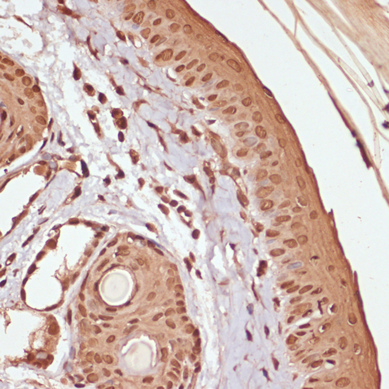 Immunohistochemistry of paraffin-embedded Rat skin using Phospho-β-catenin(S33/S37/T41) Polyclonal Antibody at dilution of  1:100 (40x lens).