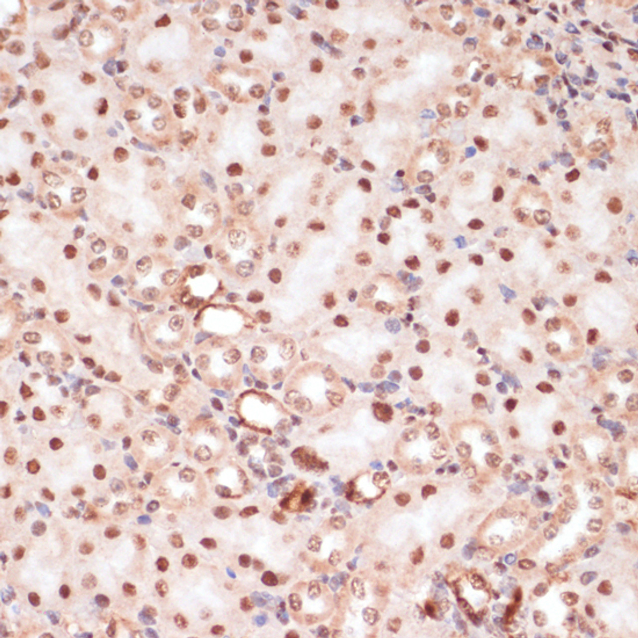 Immunohistochemistry of paraffin-embedded Mouse kidney using Phospho-β-catenin(S33/S37/T41) Polyclonal Antibody at dilution of  1:100 (40x lens).