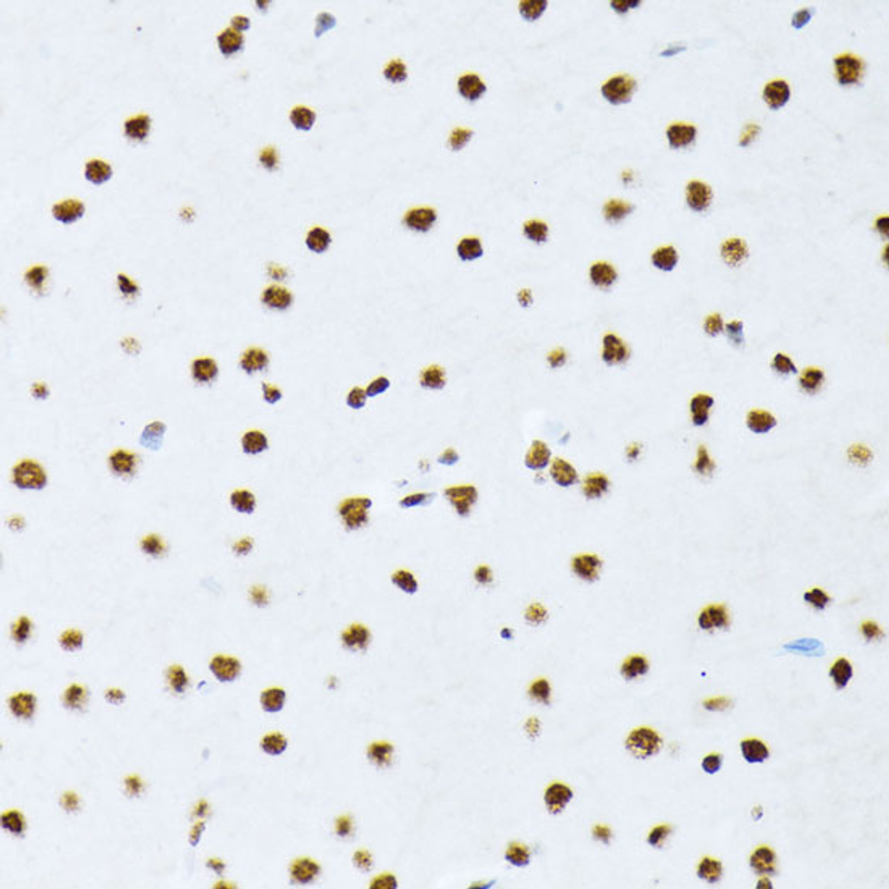 Immunohistochemistry of paraffin-embedded Rat brain using Phospho-ATF2(T69/T71) Polyclonal Antibody at dilution of  1:100 (40x lens).