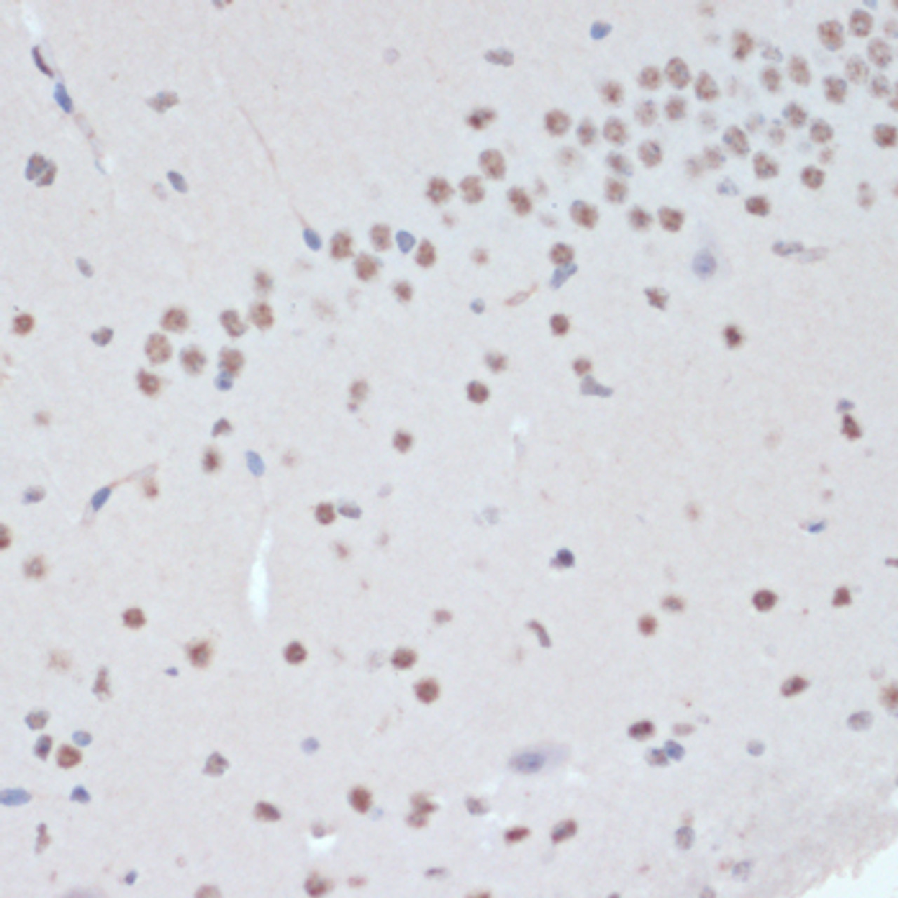 Immunohistochemistry of paraffin-embedded Mouse brain using Phospho-Jak2(Y1007/1008) Polyclonal Antibody at dilution of  1:200 (40x lens).