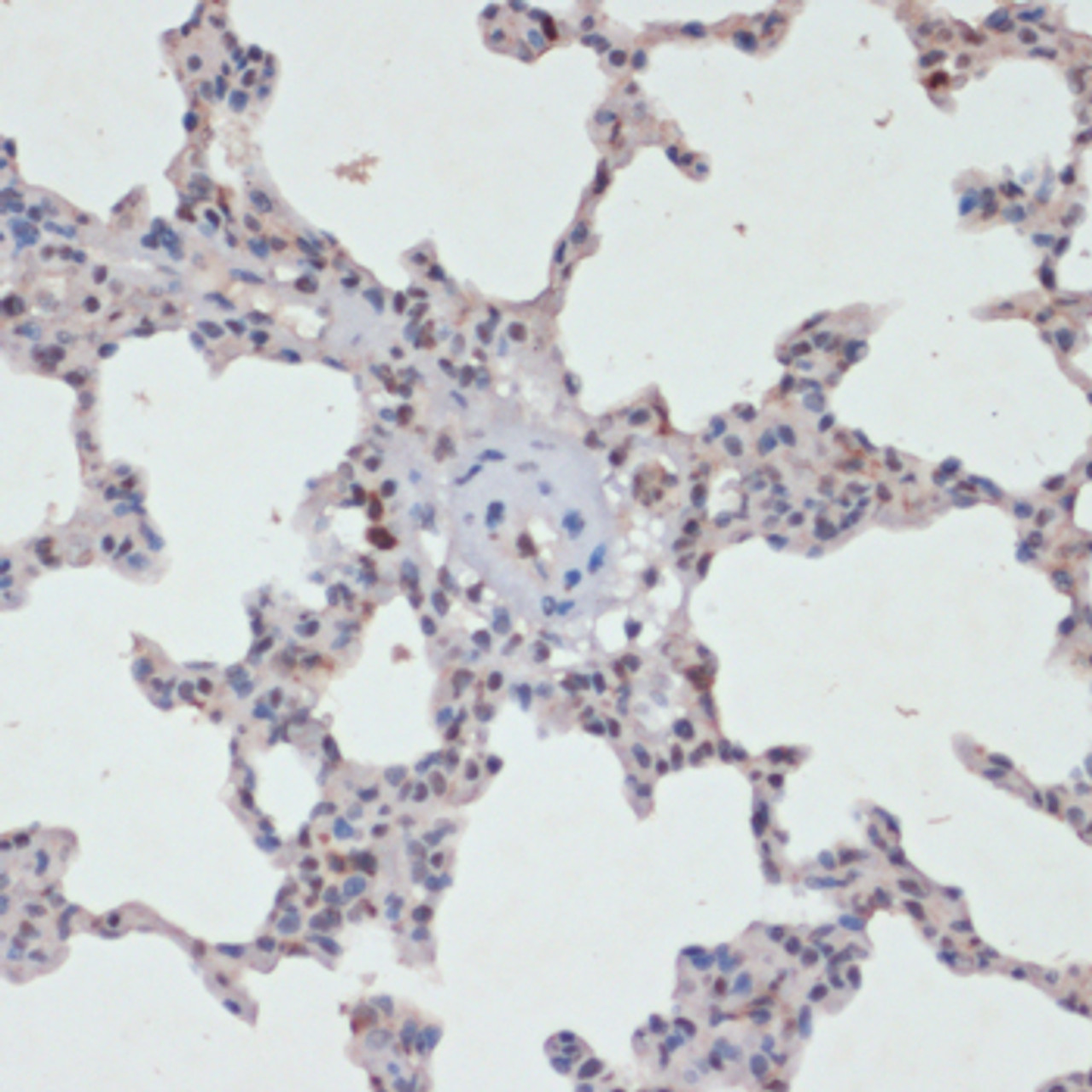 Immunohistochemistry of paraffin-embedded Rat lung using Phospho-Jak2(Y1007/1008) Polyclonal Antibody at dilution of  1:200 (40x lens).