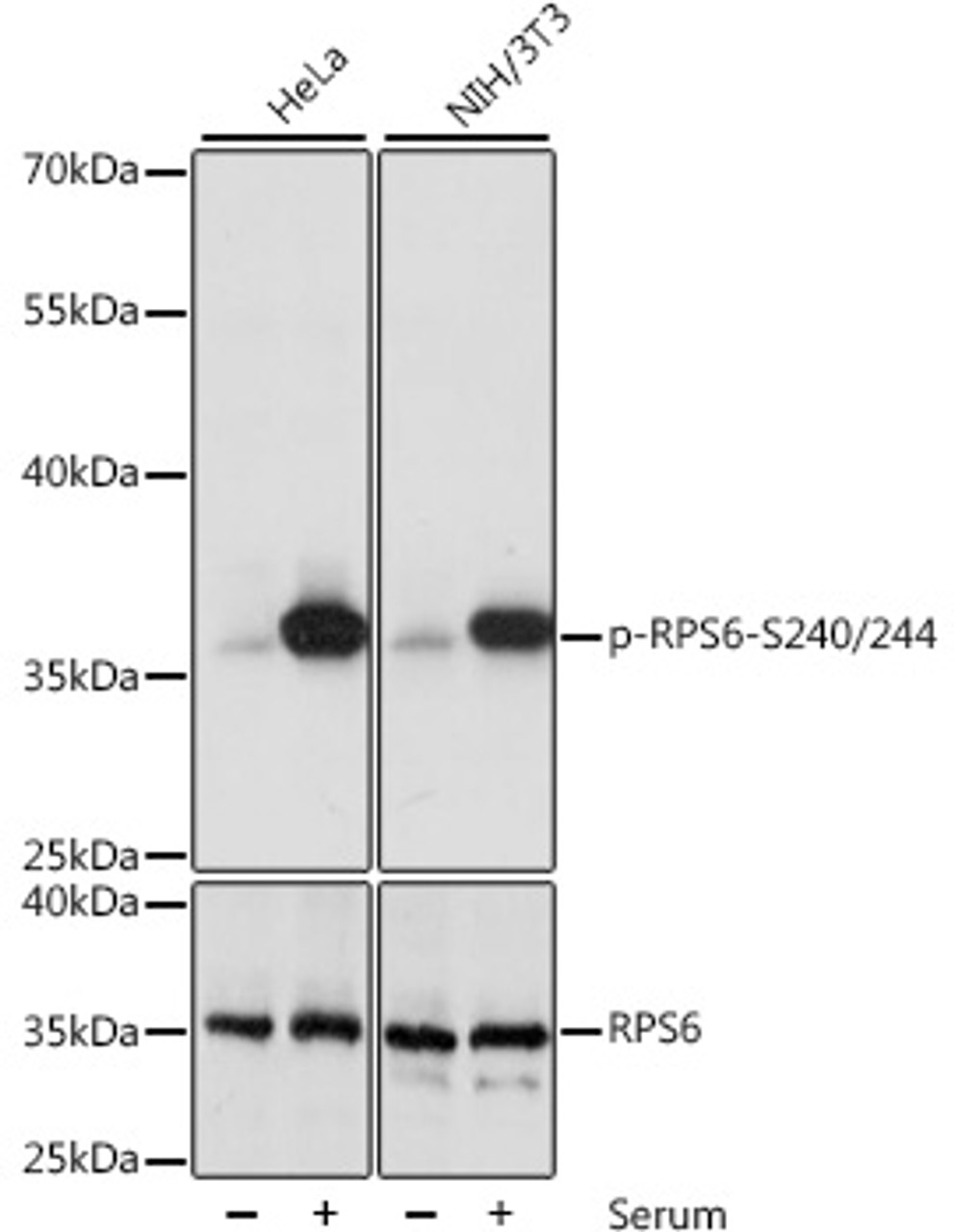 Western blot analysis of extracts of various cell lines using Phospho-RPS6(S240/244) Polyclonal Antibody at dilution of 1:1000.