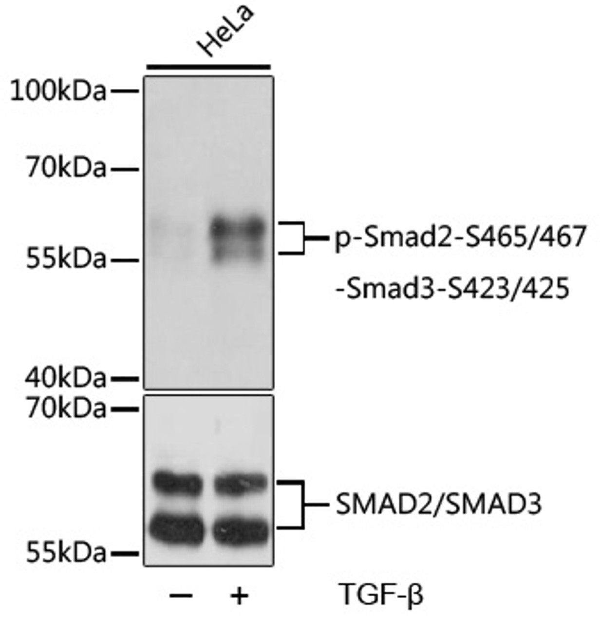 Western blot analysis of extracts of HeLa cells using Phospho-Smad2（S465/467）/Smad3（S423/425) Polyclonal Antibody at dilution of 1:1000.