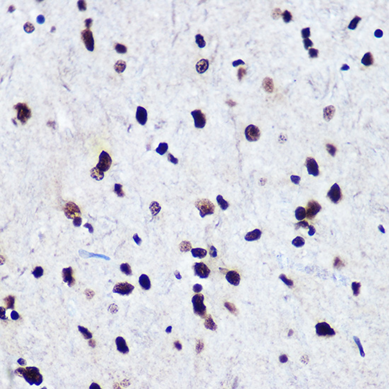 Immunohistochemistry of paraffin-embedded Rat brain using Phospho-Smad2（S465/467）/Smad3（S423/425) Polyclonal Antibody at dilution of  1:100 (40x lens).